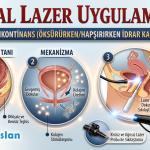 vajinal lazer uygulamaları