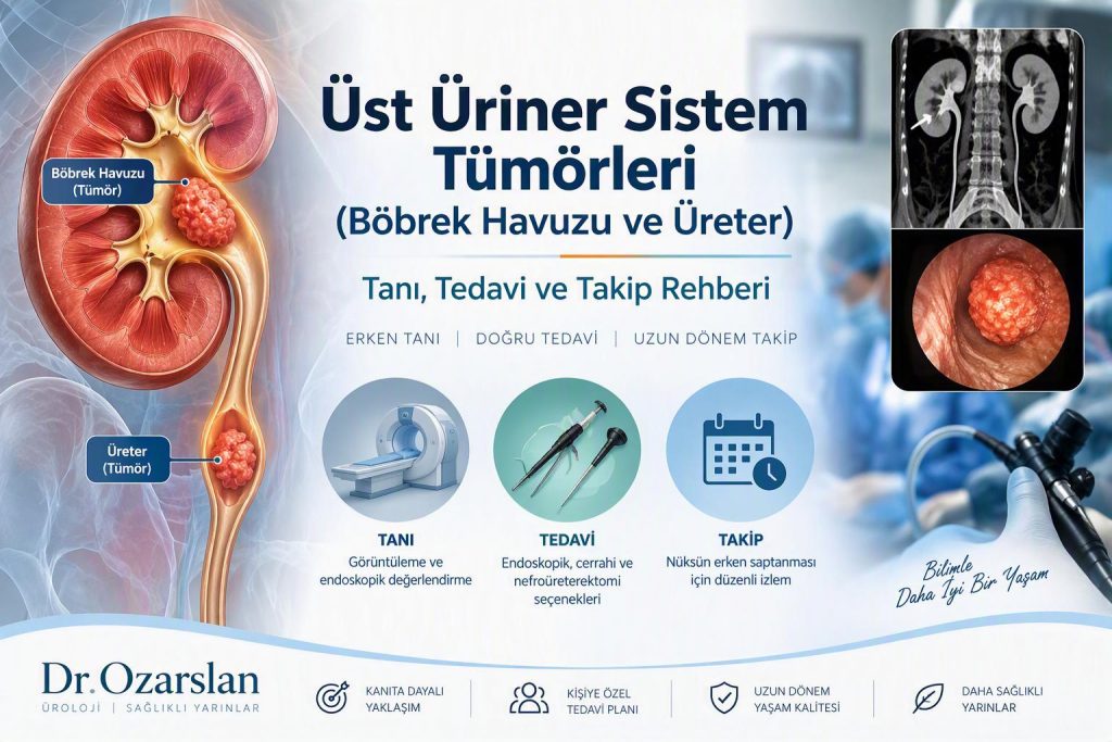 Üst Üriner Sistem Tümörleri (Böbrek Havuzu ve Üreter): Tanı, Tedavi ve Takip Rehberi