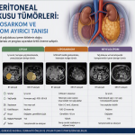 Retroperitoneal Yağ Dokusu Tümörleri: Lipom, Liposarkom ve Miyelolipom Ayırıcı Tanısı