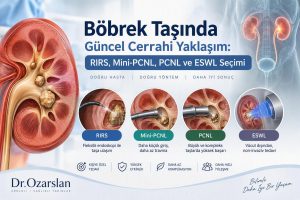 Böbrek Taşında Güncel Cerrahi Yaklaşım: RIRS, Mini-PCNL, PCNL ve ESWL Seçimi