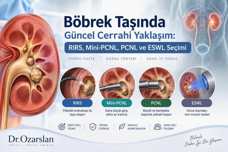 Böbrek Taşında Güncel Cerrahi Yaklaşım: RIRS, Mini-PCNL, PCNL ve ESWL Seçimi