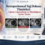 Retroperitoneal Yağ Dokusu Tümörleri: Lipom, Liposarkom ve Miyelolipom Ayırıcı Tanısı